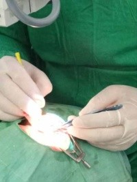 Haiti - FLASH : Thanks to Castro and Chávez, the Cubans have restored the vision to more than 72,000 Haitians