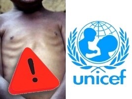 Haïti - Santé : Plus de 115,600 enfants pourraient souffrir de malnutrition aiguë sévère en 2023