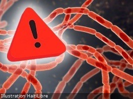 Haïti - ALERTE : Maladie du charbon (Anthrax), Haïti prend les premières mesures sanitaires