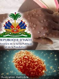 Haiti - FLASH : Important message from the Ministry of Health